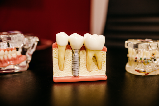 Dr benefits - Dental mold